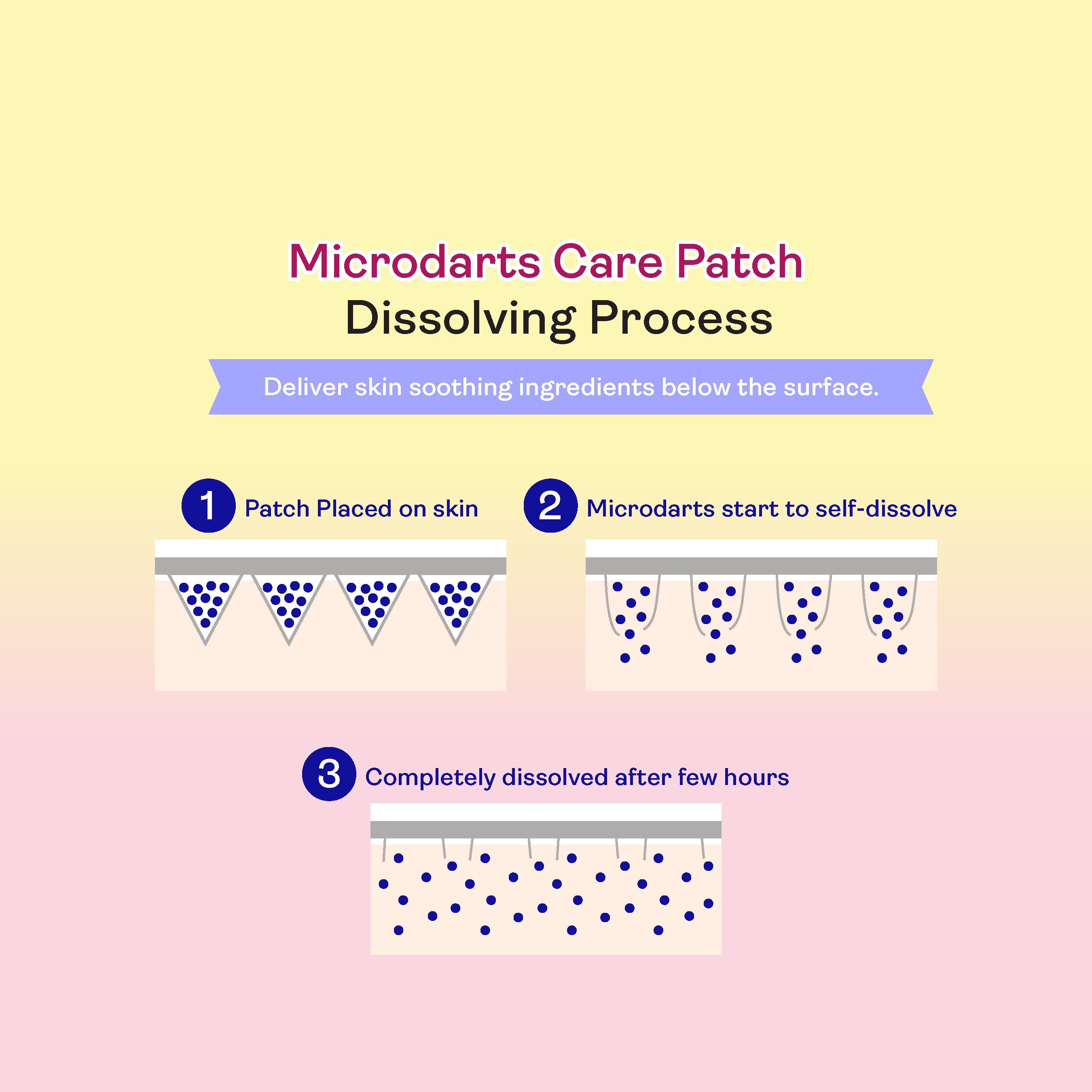 Yukazan Microdarts Care Patch for Acne Fun Shape 9's| Microneedle Patches for Blind Pimples | Pure Hydrocolloid Skincare